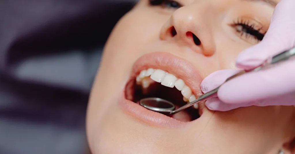 Patient receiving gentle teeth whitening for sensitive teeth in Marietta GA